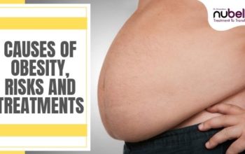 Causes of Obesity, Risks and Treatments.
