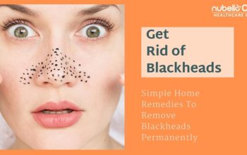 How To Get Rid Of Blackheads-Simple Remedies