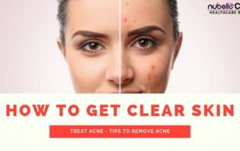 How to get clear skin – Acne free skin tips