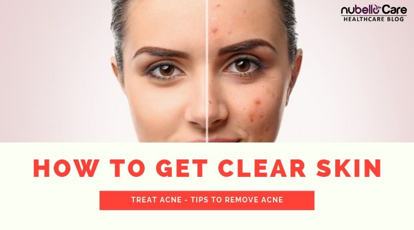 Acne free clear skin