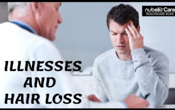 Illnesses That Cause Hair Loss