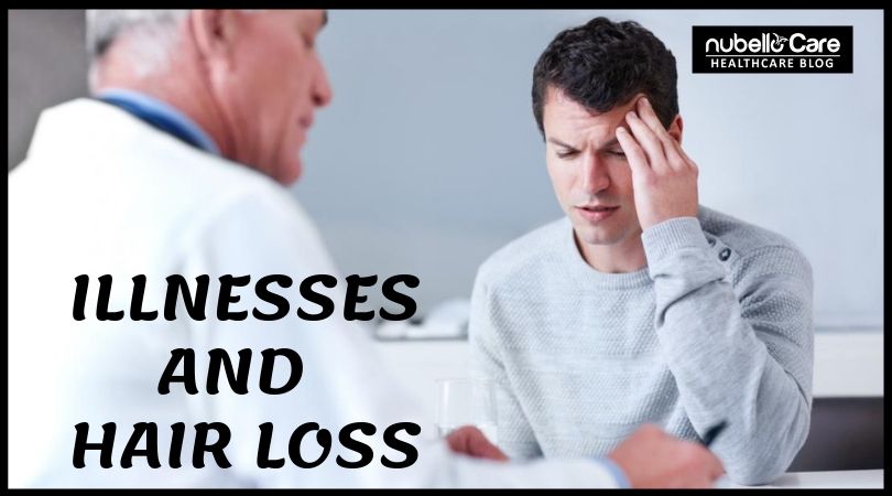 illnesses that cause hair loss men