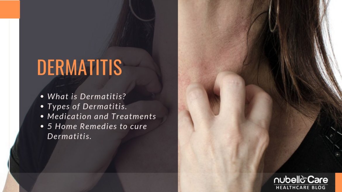 Home remedies for Dermatitis