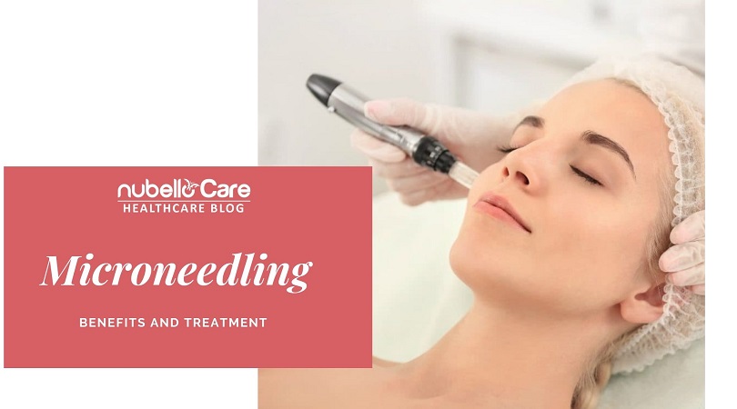 Microneedling Benefits and Treatments