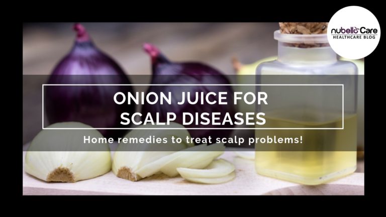 IS ONION JUICE GOOD FOR SCALP PSORIASIS