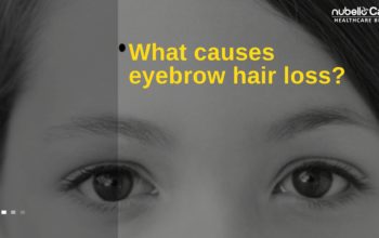 What causes eyebrow hair loss?
