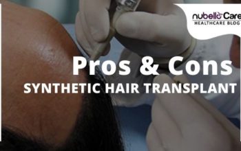 Pros and Cons of Synthetic Hair Transplant