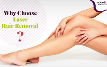 Why Choose Laser Hair Removal Instead of waxing –