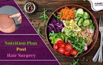 Nutrition Plan for Post Hair Surgery