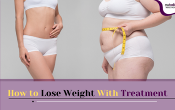 How to Lose Weight With Treatment