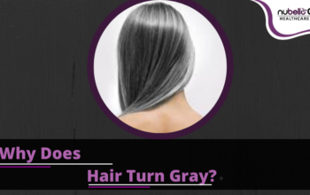 Why does Hair Turn Gray? What Causes Premature Graying Of Hair?